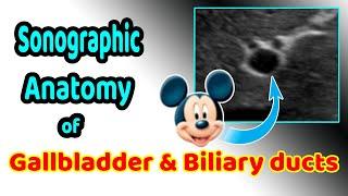 Sonographic anatomy of the gallbladder and biliary ducts