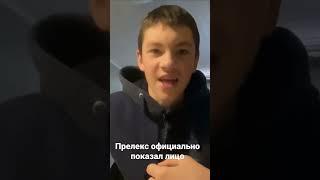 Прелекс оффициально спалил лицо