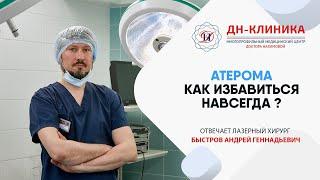 Что такое АТЕРОМА? Чем она опасна и как ее лечить? Как удаляют атеромы?