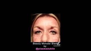Beauty Monster Black with Plasma tip(Whole face care)