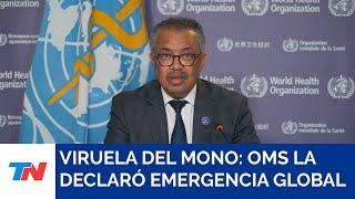 La OMS declaró a la viruela del mono como una emergencia de salud pública internacional