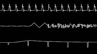 C64 Rob Hubbard's "Lightforce" Oscilloscope view