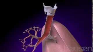 Bronchitis Animation