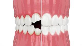 Boost Your Confidence with Cosmetic Dentistry