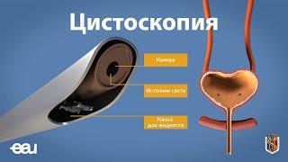 Цистоскопия (EAU - cystoscopy RU)