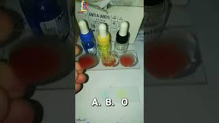 ABO blood grouping.