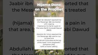 Hijama done on the Prophet #solutions_for_seha_and_soul