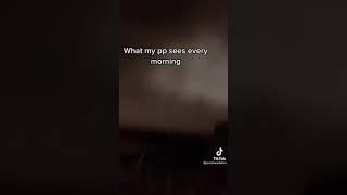 What my pp sees every morning (POV)