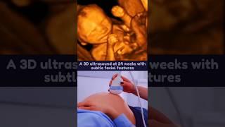 24 Weeks 3D Ultrasound with Facial Details 