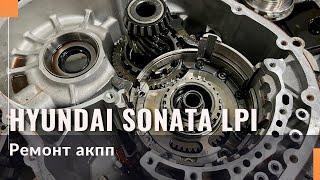 Капітальний ремонт АКПП Hyundai Sonata LPI з пробігом 500 000 км.