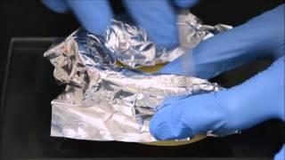 CUSTOM-MADE TRAY FOR FIXED PARTIAL DENTURE IMPRESSIONS
