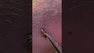 Как эффективно извлечь жало пчёлы / How to effectively remove a bee sting 