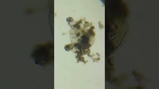 Tardigrade munching away on algae #microorganism #tardigrade #algae