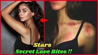 Bollywood Stars Who Were Caught Red Handed With Their Love Bites | You Never Noticed