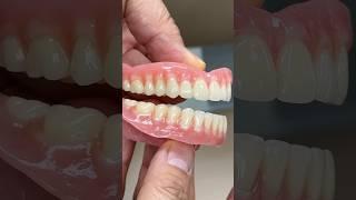 Magnificent Process Dentures #lsk121shorts #teeth #dental