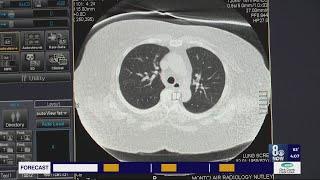 Project hopes to boost detection of lung cancer