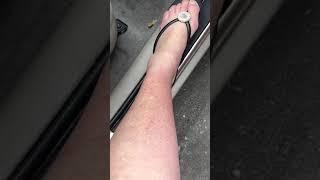 4/5/20 My legs and feet burnt while sleeping in my car