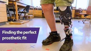 Finding the perfect prosthetic fit - Sanders UW Research Labs