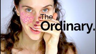 The Ordinary 3 Best Rosacea Products For Redness & Sensitive Skin Routines