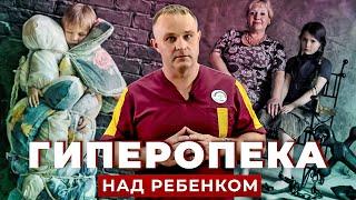 ГИПЕРОПЕКА | Как гиперопека влияет на ребенка | Ошибки родителей в воспитании детей