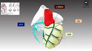 Coronary Artery Anatomy