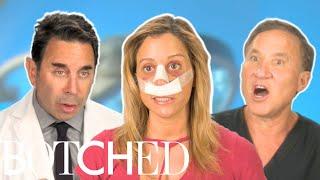 Dr. Nassif Transforms Norina's "Ski Lift" Nose FULL TRANSFORMATION | Botched | E!