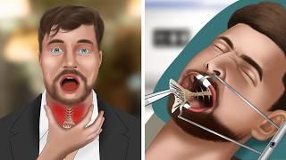 [ASMR Animation] Remove fish bones stuck in MrBeast's throat