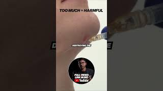 Fat Dissolving Injections For Double Chin (Cannula) How-To