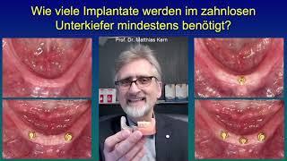 Wie viele Implantate werden im zahnlosen Unterkiefer mindestens benötigt?