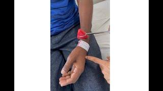 Inverted radial / brachioradialis reflex: A localizing sign; Department of Medicine; DMIHER