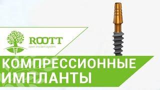 Компрессионные импланты  Все преимущества компрессионных имплантов ROOTT