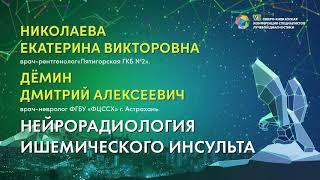 Нейрорадиология ишемического инсульта - Николаева Екатерина Викторовна, Дёмин Дмитрий Алексеевич