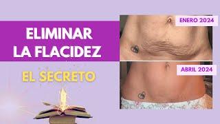 ¿Qué es LO MEJOR para ELIMINAR FLACIDEZ ABDOMINAL?