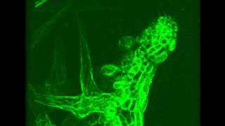 Arabidopsis trichome development Actin-GFP