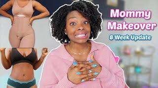 8 Weeks Post-Op Update | Lymphatic Massage, Fajas, Swelling | Mommy Makeover Recovery Q&A