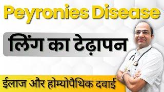 Peyronie's Disease | लिंग का टेढ़ापन कैसे दूर करें | Best Homeopathy Medicine