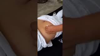 Indian Women H Injection New Video Intramscular IM Injection  |#viral #videos #youtube #injection