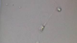 СПЕРМАТОЗОИДЫ под МИКРОСКОПОМ!!!  Spermatozoa UNDER MICROSCOPE!!!