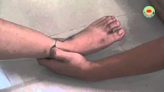 Kỹ thuật Khai thông MẠCH MÁU ở Chân - Bài giảng Thập Chỉ Liên Tâm - liệu pháp Y mao mạch