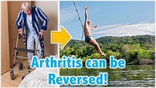 Arthritis can be Reversed!