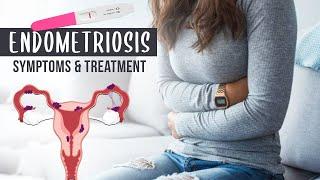 Endometriosis Symptoms & Treatment | Dr Sasirekha Kumaran | Jeevan Women Care