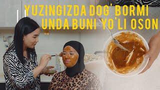 Yuzingizdda dog' bormi? Unda juda osson usuli Odina Tuxtasinovadan