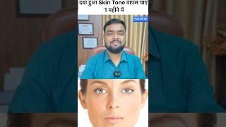 Get back your original skin tone in one month #pigmentation #skincaretips #skinhealth #lucknow