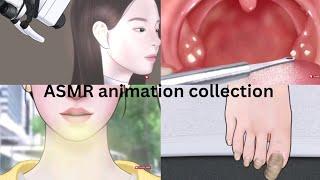 [ASMR] Earwax, athlete's  foot toenails tonsil stones|ASMR animation Removing Huge nevel stone