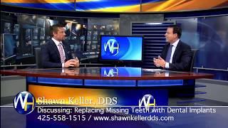 All ON 4 Dental Implants with Kirkland WA Dentist Shawn Keller DDS