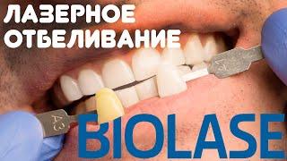 Лазерное отбеливание зубов Biolase