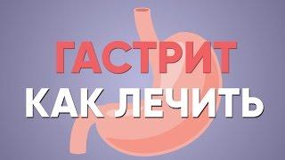 ГАСТРИТ что делать? | Симптомы | Лечение | Диета | Хронический Обострение | Как лечить | Доктор Фил