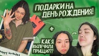 О НАБОЛЕВШЕМ | ЧТО ПОДАРИЛИ НА ДЕНЬ РОЖДЕНИЯ? КАК Я ВЫЛЕЧИЛА ПРЫЩИ