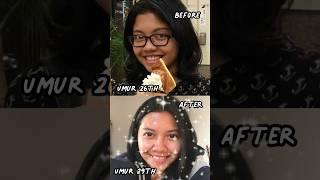 Tips #glowup pake #skincarejepang ala IndyRin! Semua pasti bisa glow up! #beautytips