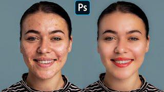 Face Retouching - Best Photoshop Tutorial | Skin Retouching